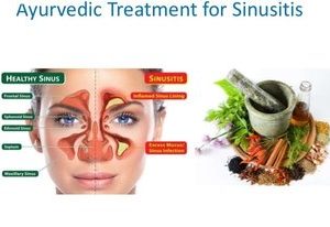 Asthaayurveda – Ayurvedic Treatment for Sinus