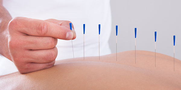 Best Acupuncture Treatment By City Acupuncture