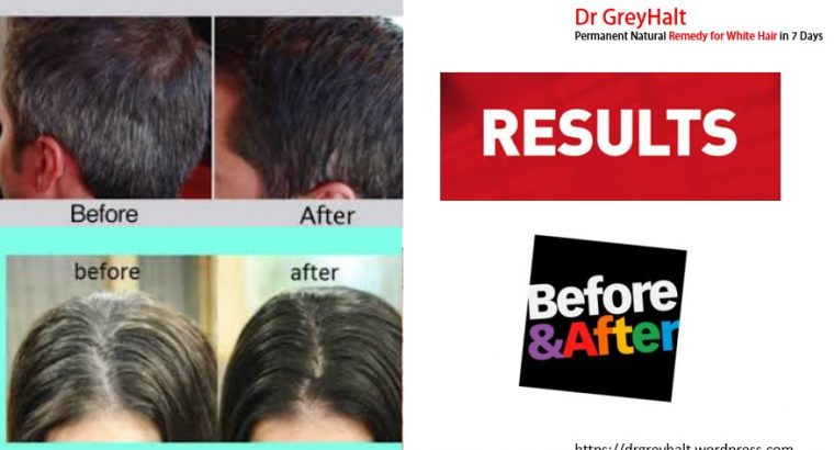 Dr GreyHalt Advantages for Grey Hair Treatment To Make White Hair Black