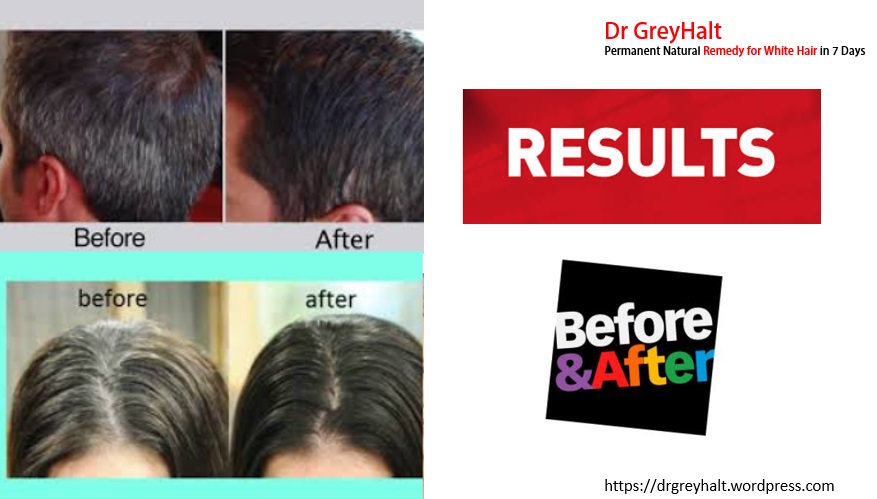 Dr GreyHalt Advantages for Grey Hair Treatment To Make White Hair Black