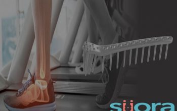 Top Orthopedic Implants Company | Siiora.mx