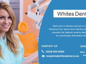 Composite Bonding at Whites Dental