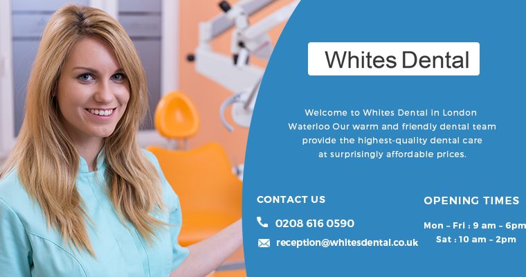 Composite Bonding at Whites Dental