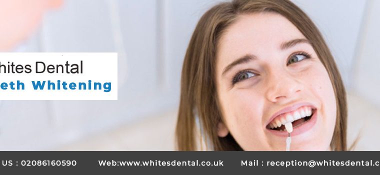Teeth Whitening At Whites Dental London