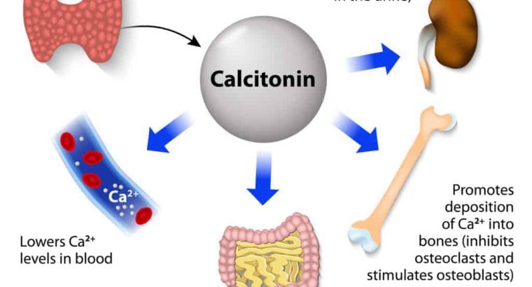 Dr. Steven Invention Calcitonin-Salmon Nasal Spray is used to treat osteoporosis