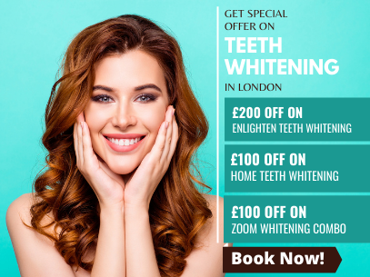 Teeth Whitening offers in London – Up to £200 off