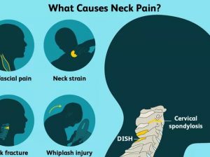 Ayurvedic Treatment for Cervical Spondylosis – Ayur Bethaniya