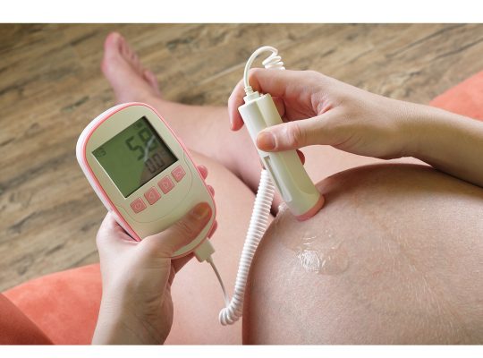 Fetal Dopler IN NIGERIA BY SCANTRIK MEDICAL SUPPLIES