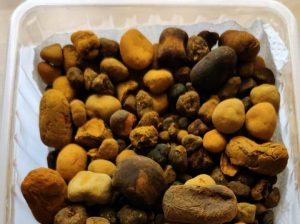 High Quality Natural Dried COW ox Gallstones……whatasapp……+254770172338