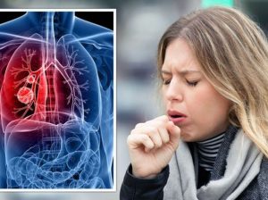 Knowledgeable Lung cancer Surgeon in jaipur