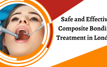 Safe and Effective Composite Bonding Treatment in London