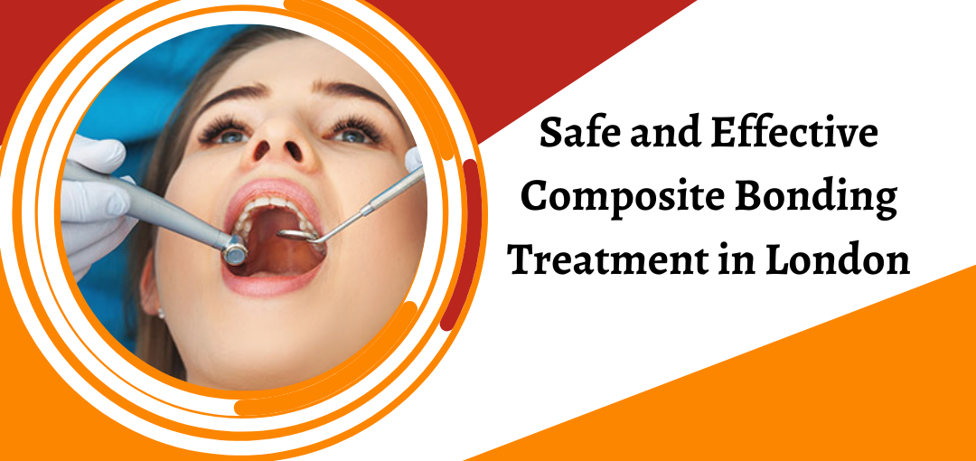 Safe and Effective Composite Bonding Treatment in London