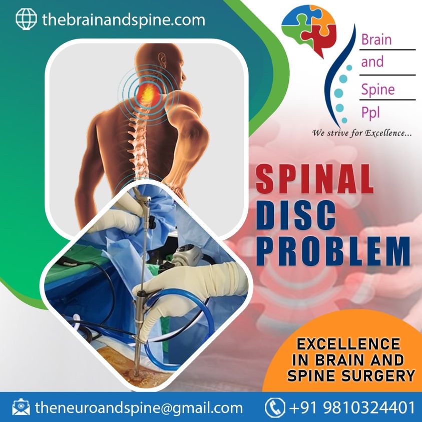 Panacea spine specialist doctor in Delhi