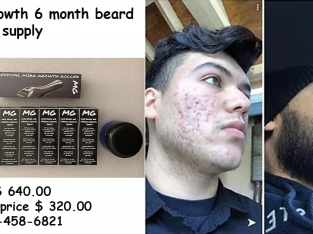 Mira-Growth 6 month beard kit grow supply