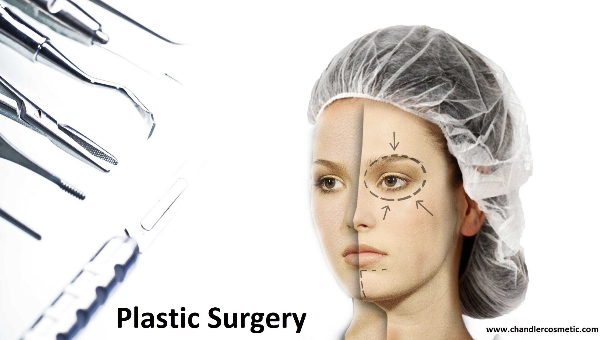 Looking for Low-Cost Plastic Surgery in Philadelphia