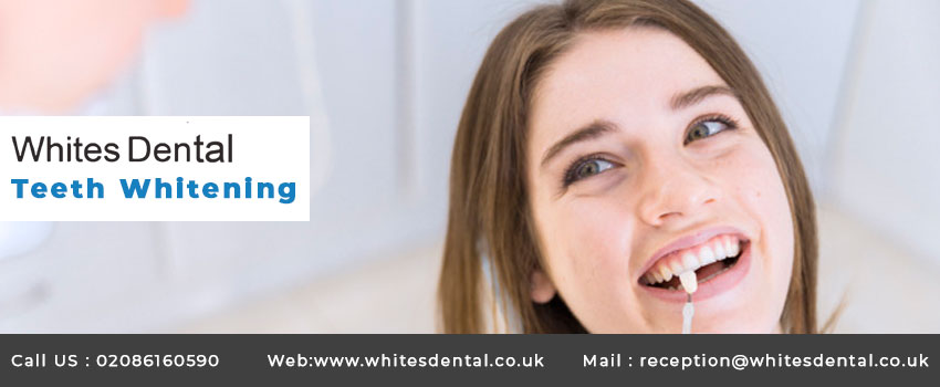 Teeth Whitening With Braces