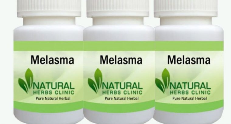 Utilize Herbal Product to Treat Melasma