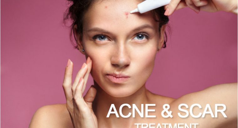 Acne & Scar Treatment in Kolkata