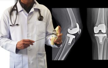 Looking for the Best Knee Specialist Doctor in Delhi? Visit Orthopaedic and Spine Clinic