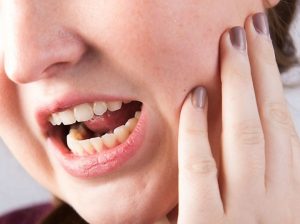 Wisdom Teeth Removal Surgery: Preparation and Recovery