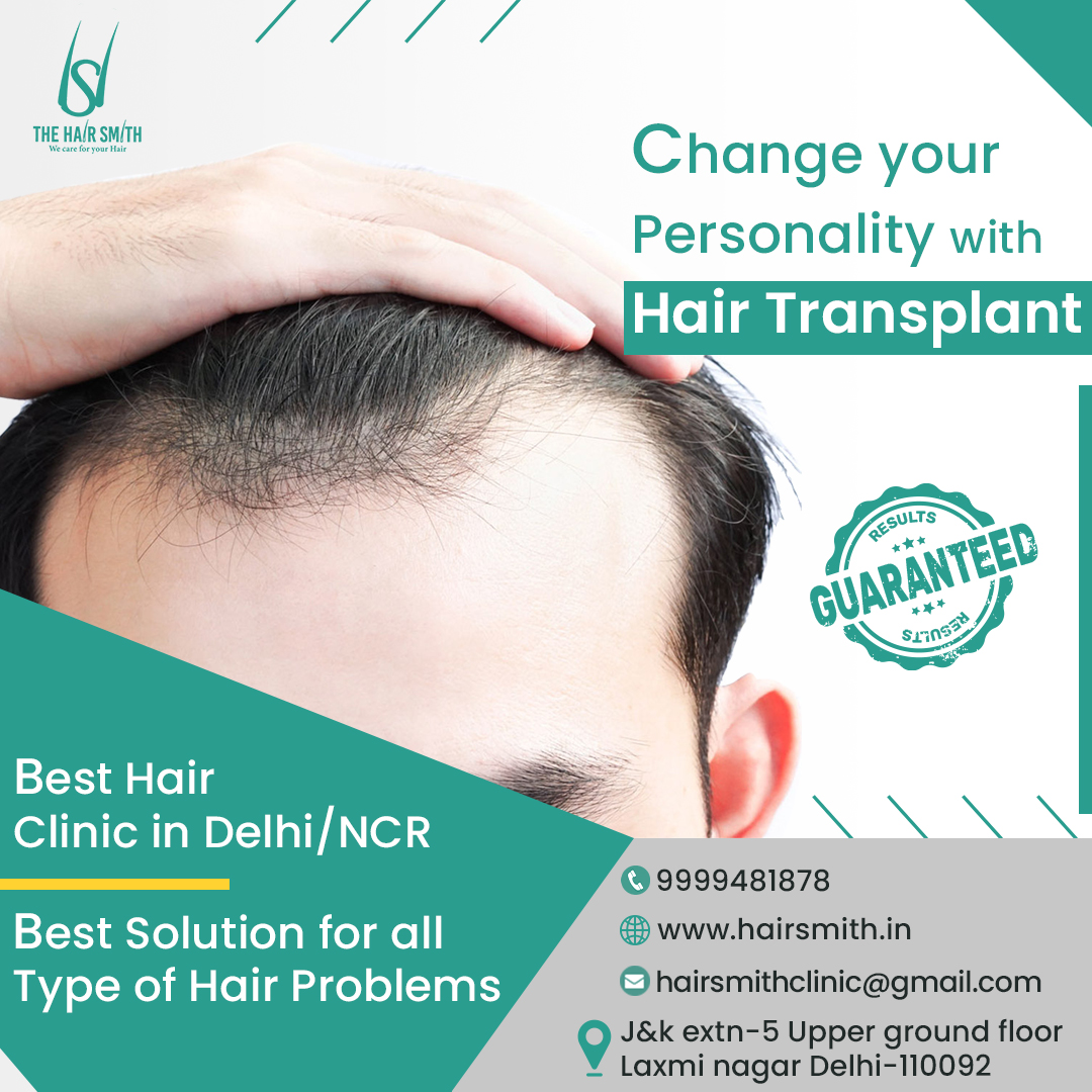 Best doctor for hair loss treatment in East Delhi