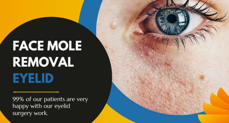 Face mole removal under eye and upper eyelid