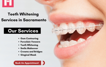 Best Teeth Whitening Services in Sacramento