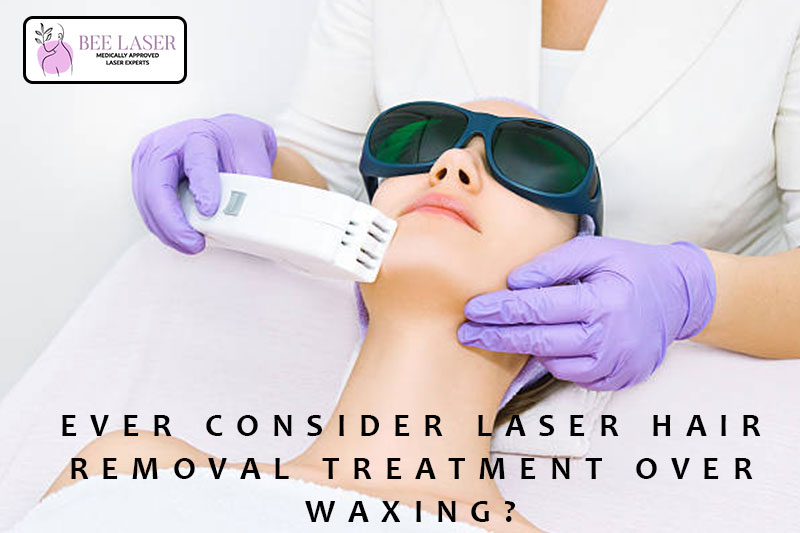 Ever Consider Laser Hair Removal Treatment Over Waxing?