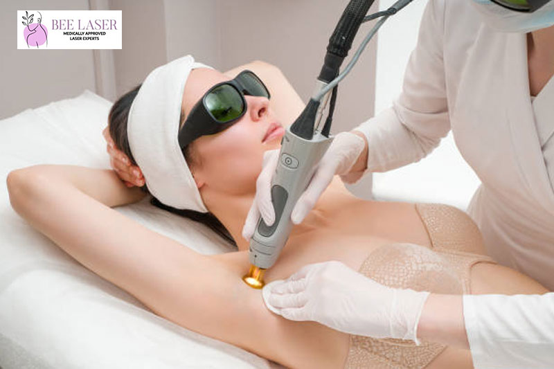 Do You Realise How Effective LHR (laser hair removal) Is?