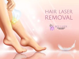 Can laser hair removal be performed on scarred areas?
