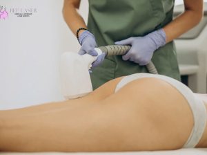 What Is The Procedure For Laser Hair Removal?