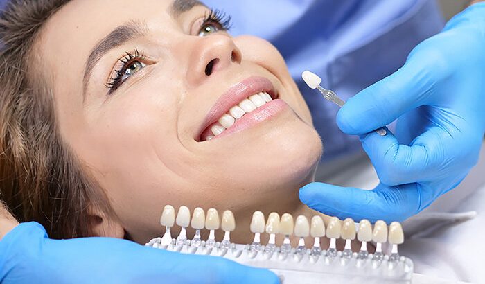 Best Dental Clinic in Walden for Teeth Whitening