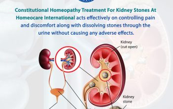 Homeopathy Treatment for Kidney Stones | Kidney Stones Treatment in Homeopathy – Homeocare International