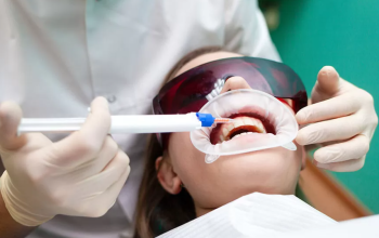 Teeth Whitening In Abu Dhabi | Best Teeth Whitening UAE
