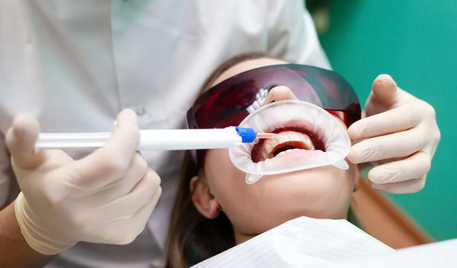 Teeth Whitening In Abu Dhabi | Best Teeth Whitening UAE
