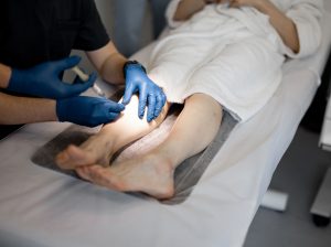 Get Sclerotherapy Treatment in Virginia with AMARA’s Experts