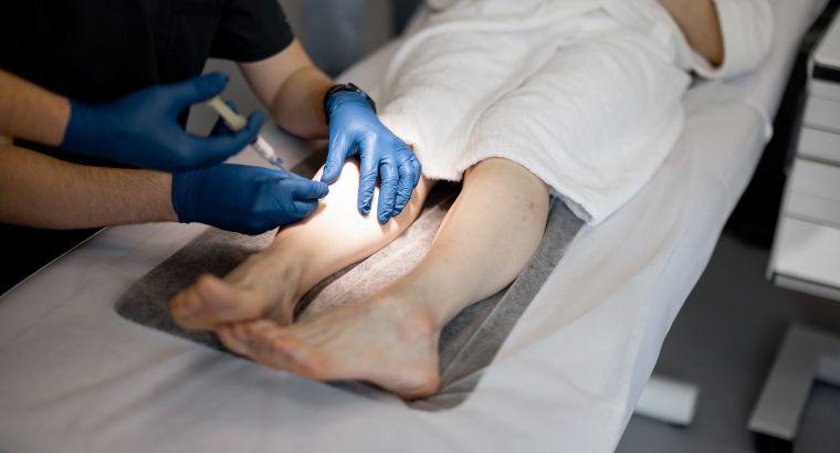 Get Sclerotherapy Treatment in Virginia with AMARA’s Experts