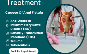 Anal Fissure Treatment (non-surgical) In Okhla, Delhi