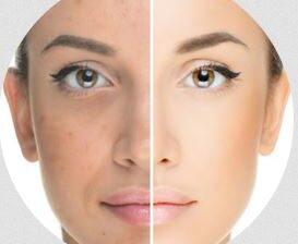 Skin Whitening Treatment in Punjab