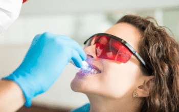 Achieve a Radiant Smile with Teeth Whitening Services