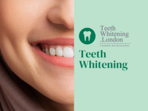 Reveal a Brighter Smile with Professional Teeth Whitening in London
