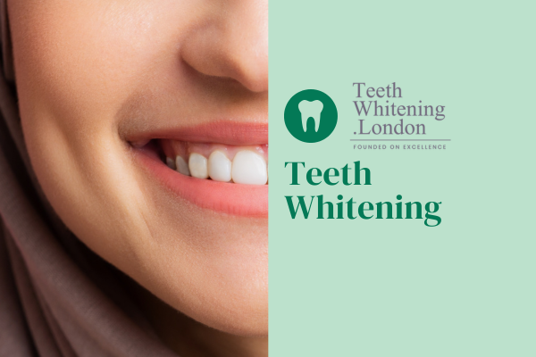 Reveal a Brighter Smile with Professional Teeth Whitening in London